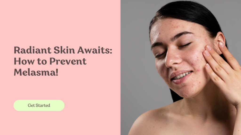 Radiant Skin Awaits: How to Prevent Melasma